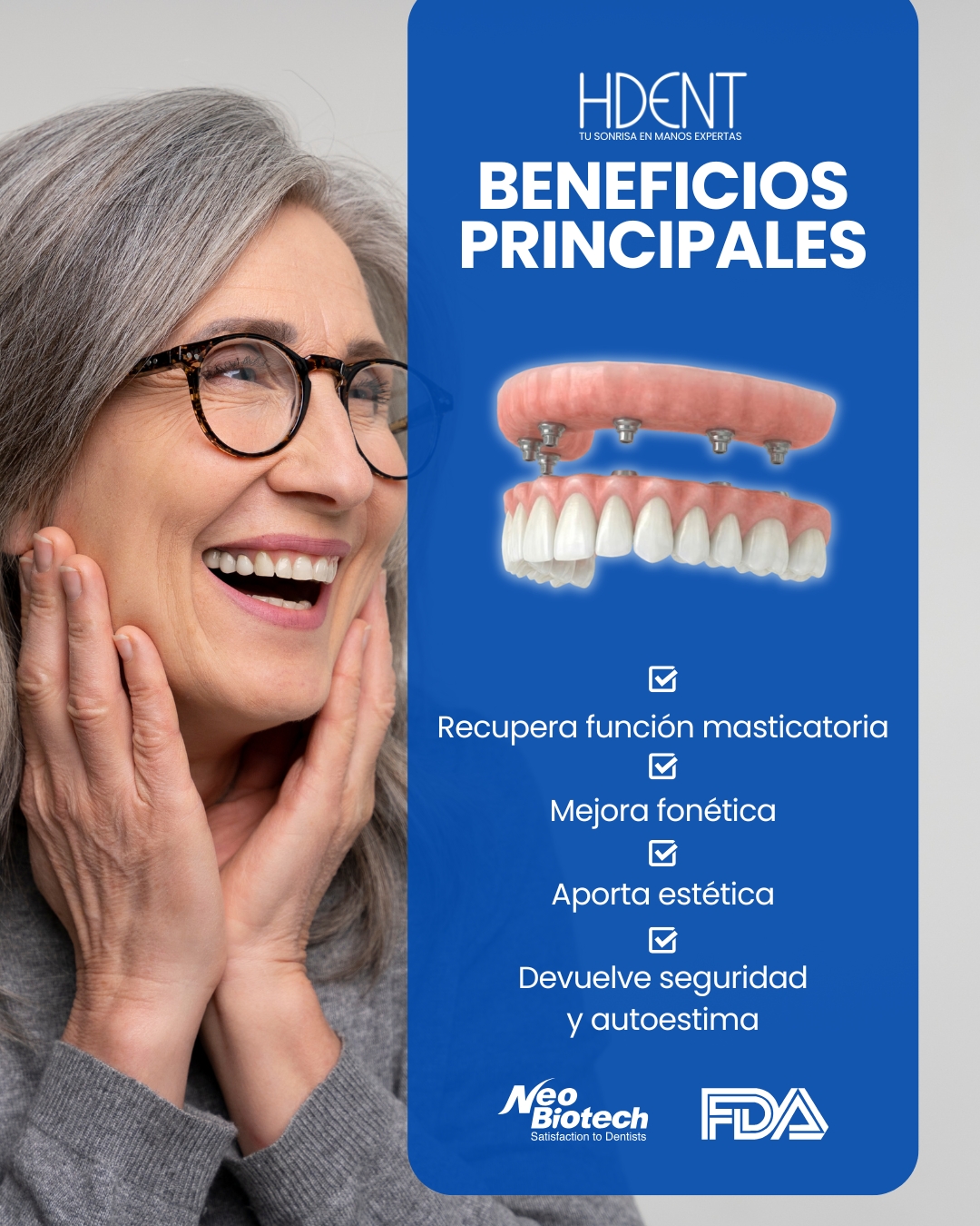 implantes dentales