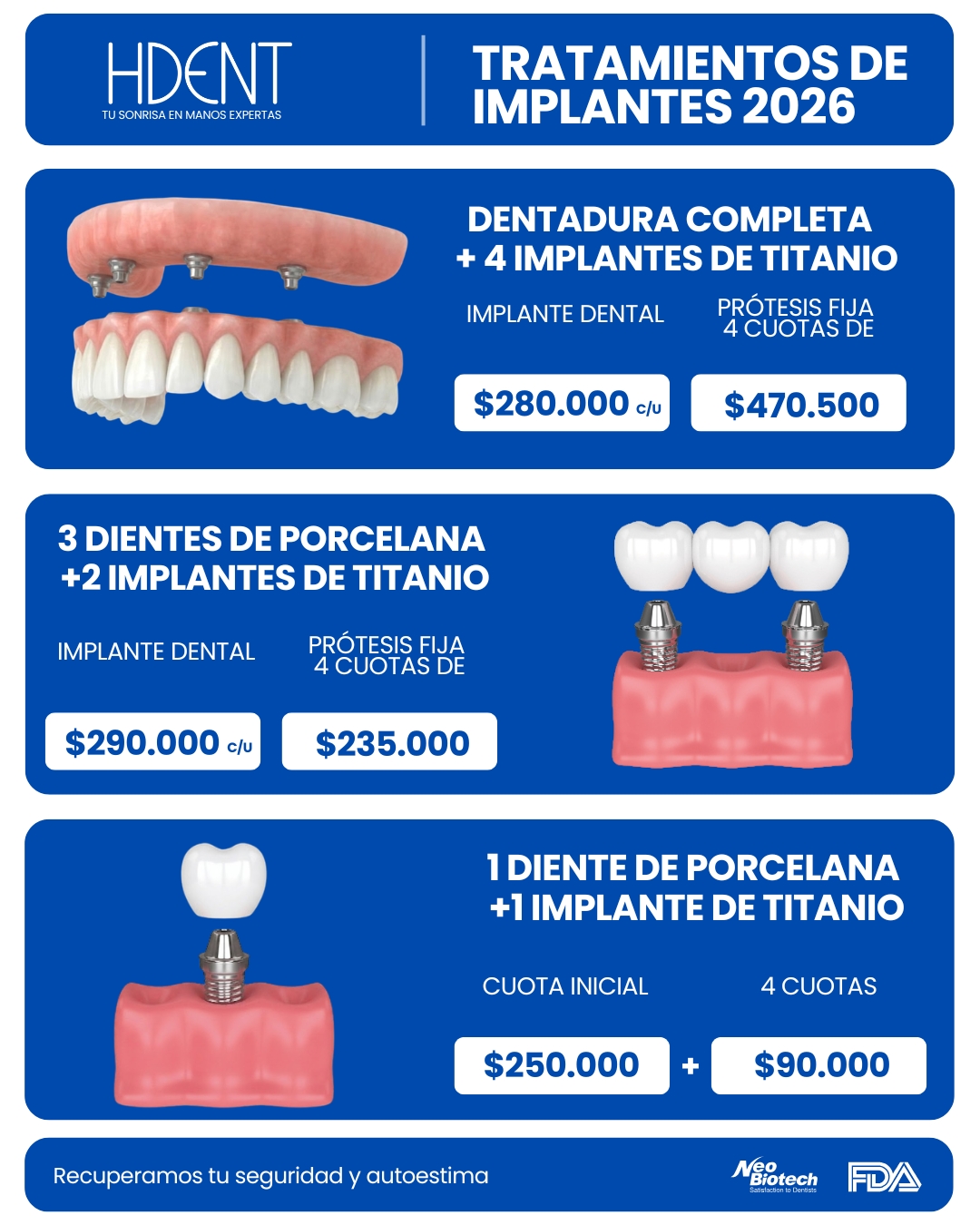 precio de implantes dentales